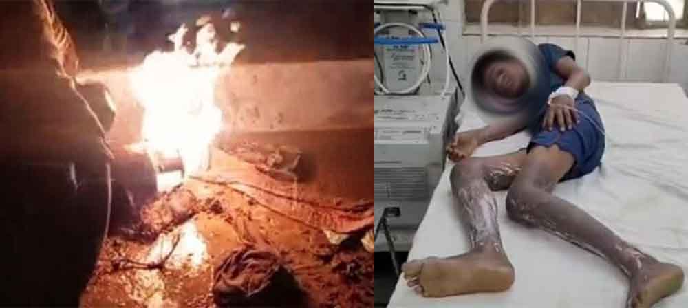 राजस्थान-अलवर में गैस सिलेंडर में लीकेज से झुलसा किशोर, चाय बनाकर गैस बंद करते समय हादसा