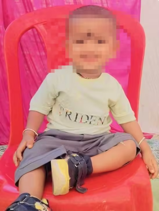 बीडीएम अस्पताल की लापरवाही से 22 माह के मासूम