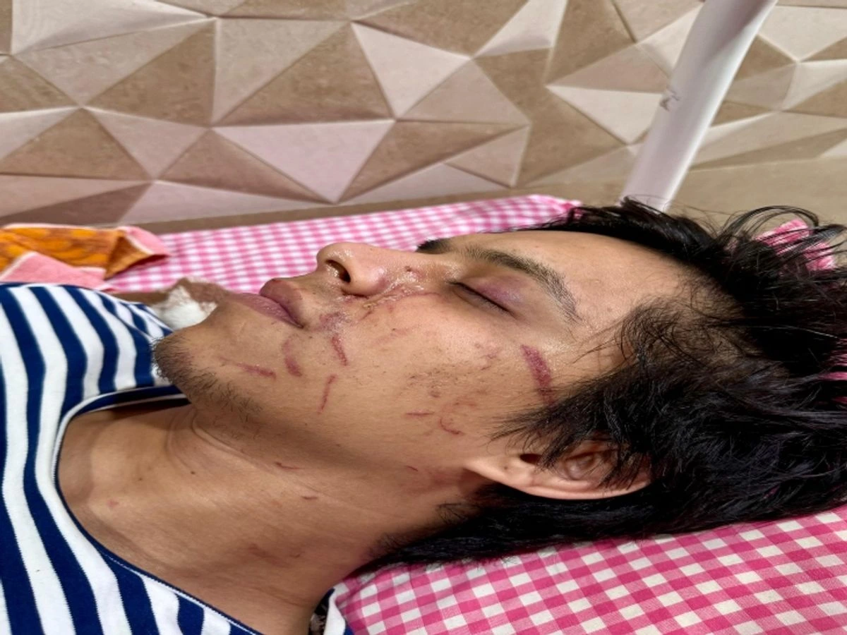 रायपुर में कांग्रेस नेताओं संग रेस्टोरेंट विवाद, युवक घायल